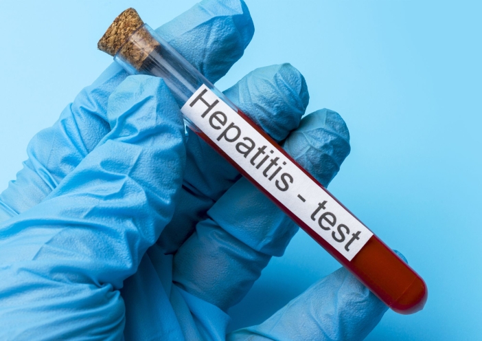 žloutenka ilustrační obrázek